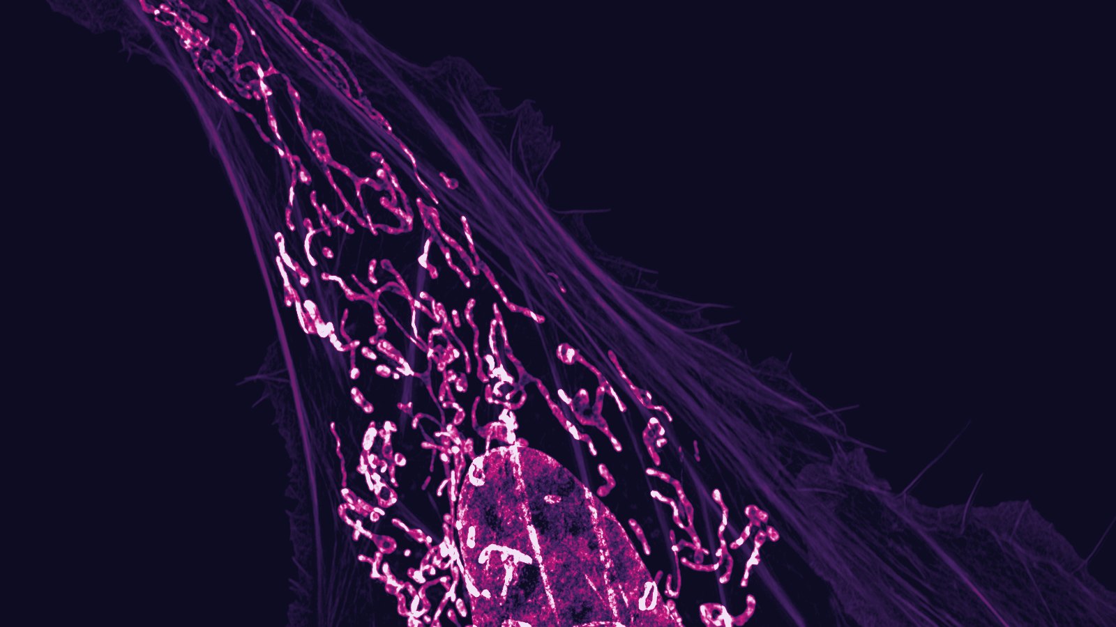 Osteosarcoma cell: nucleus, mitochondria and actin filaments. Dylan Burnette and Jennifer Lippincott-Schwartz, National Institutes of Health (Public domain)