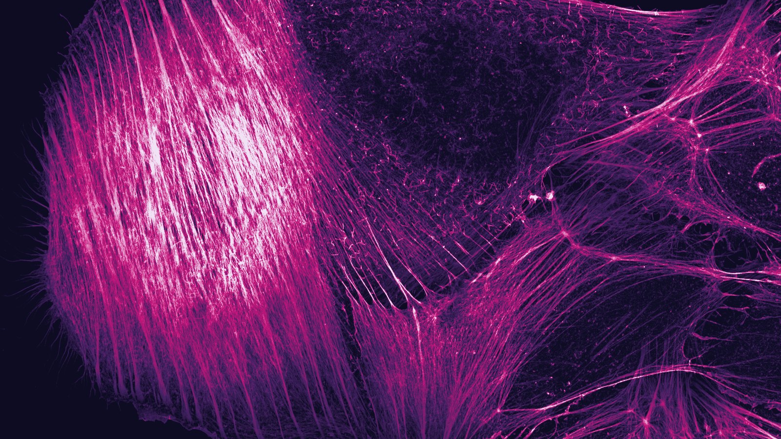 Osteosarcoma cell, depth-coded actin filaments. Howard Vindin, via Wikimedia Commons (CC BY-SA 4.0)