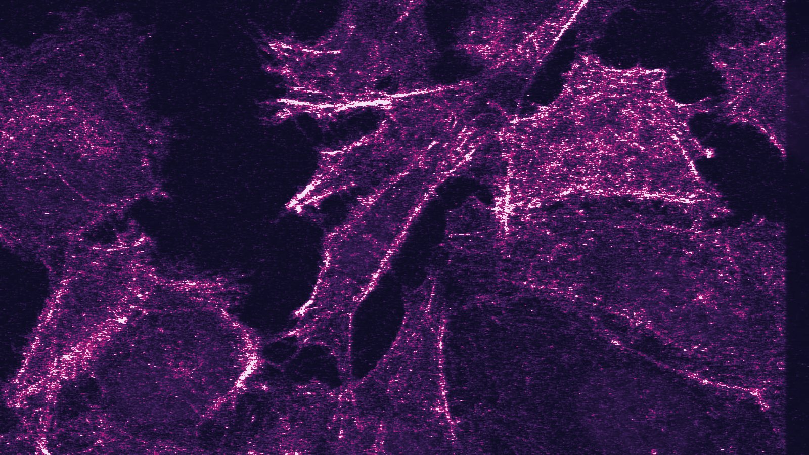 PC3 prostate cancer cells, confocal microscopy (actin and nuclei). Griersonj5, via Wikimedia Commons (CC BY-SA 4.0)